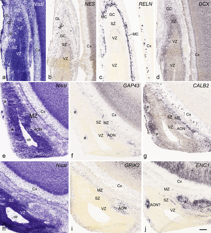 FIGURE 22