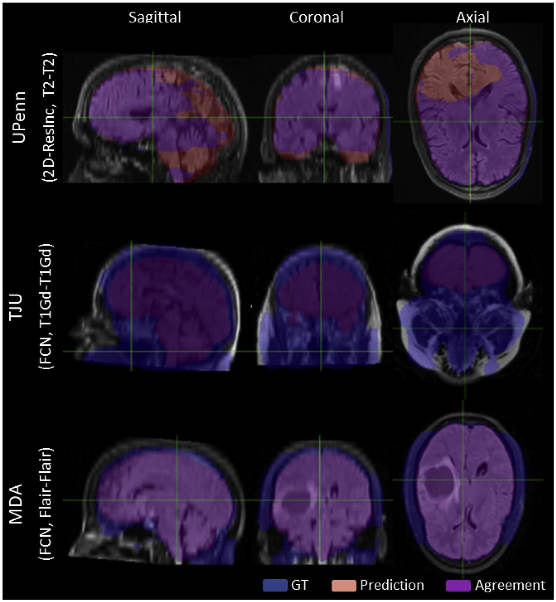 Fig. 15.