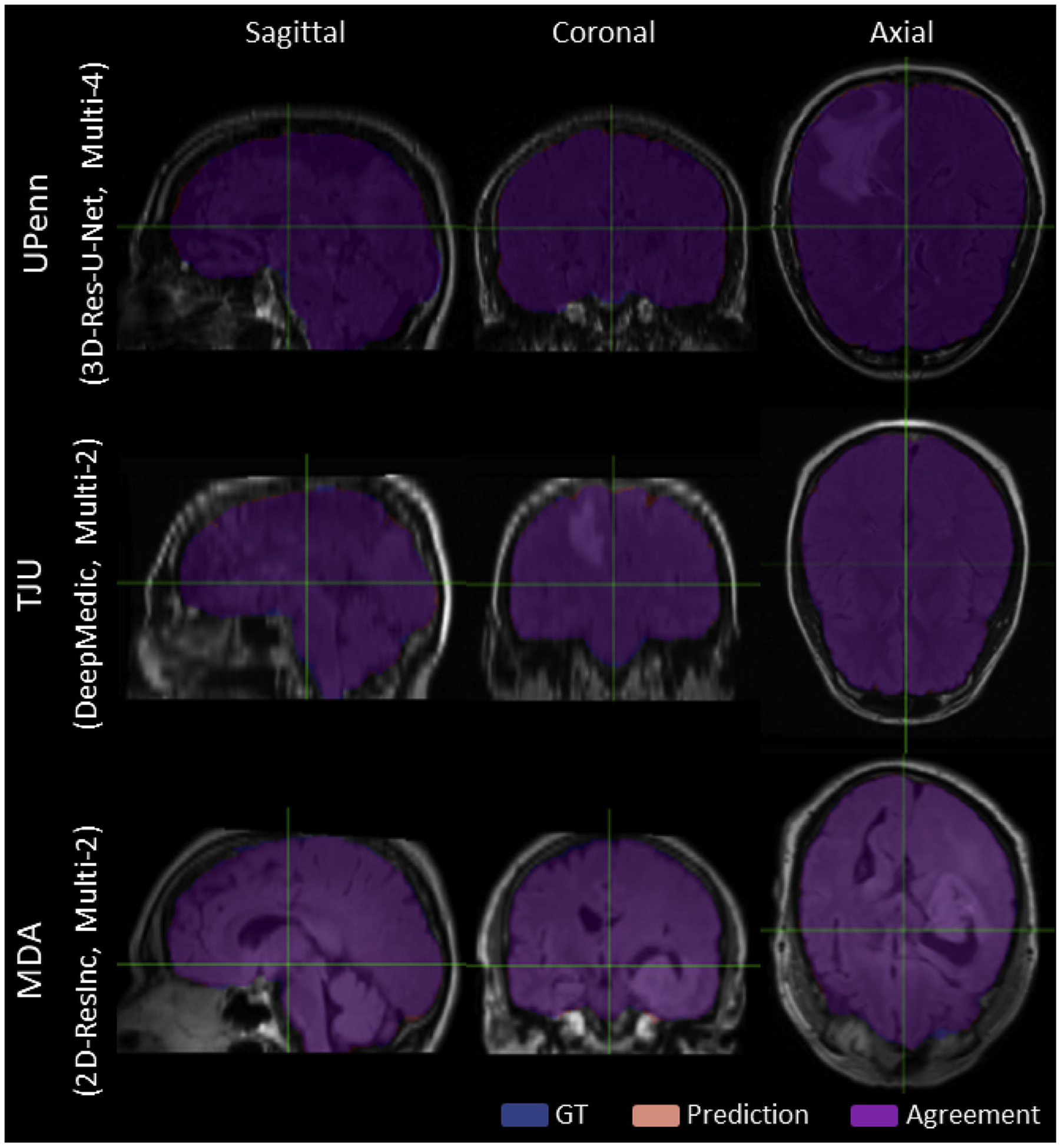 Fig. 16.