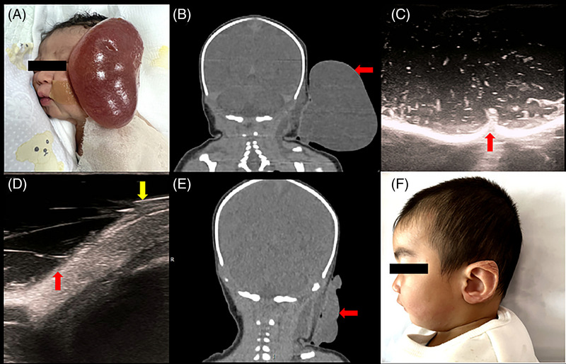 FIGURE 1