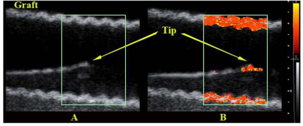 FIG. 3