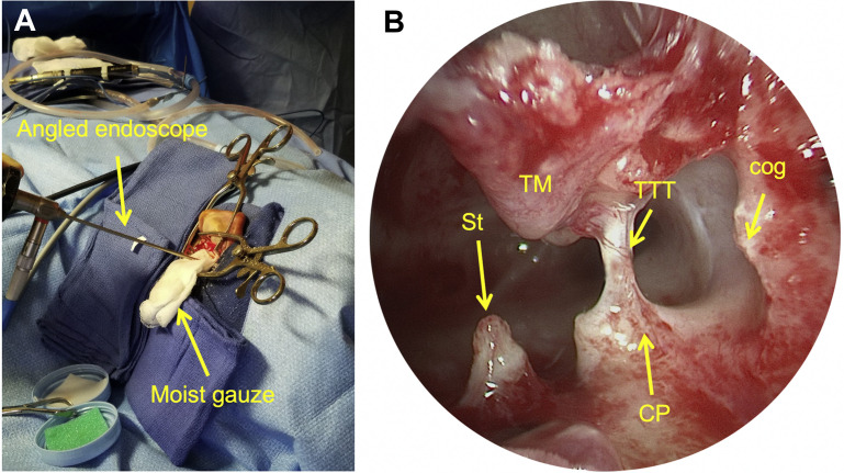 Fig. 4