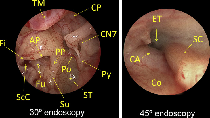 Fig. 3