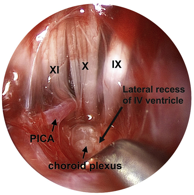 Fig. 6