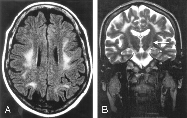 Fig 3.