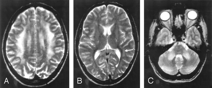 Fig 2.