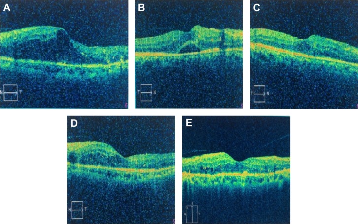 Figure 4