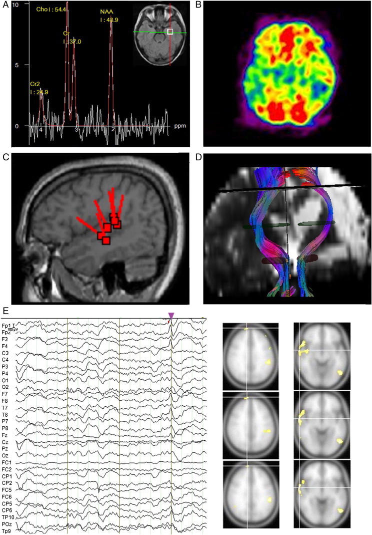 Fig. 2