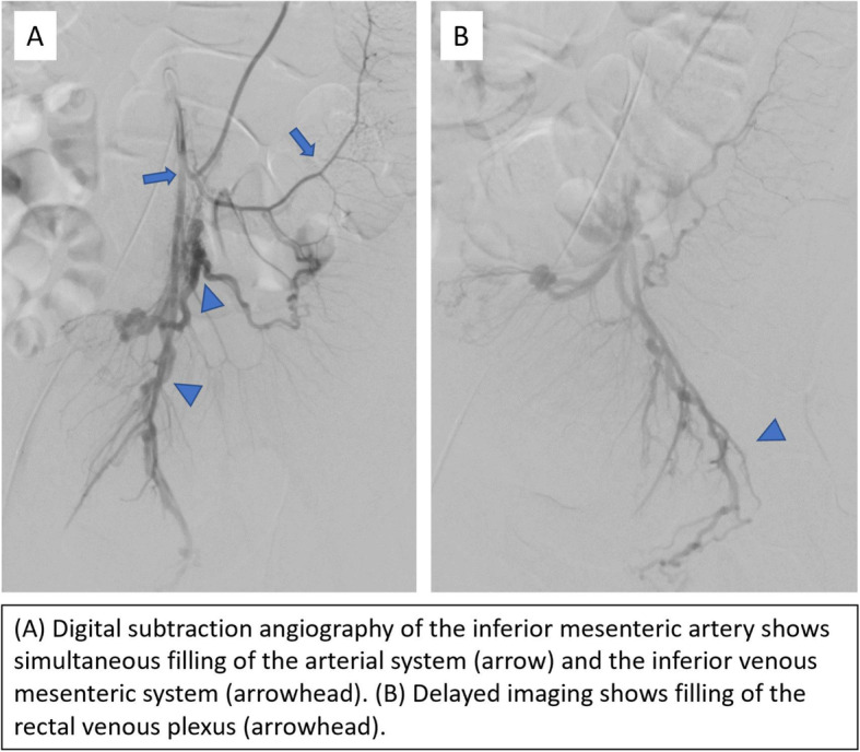 graphic file with name 42155_2021_272_Fig2_HTML.jpg