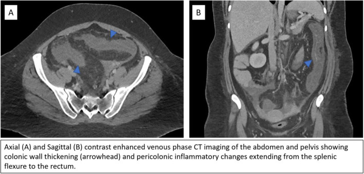 graphic file with name 42155_2021_272_Fig1_HTML.jpg