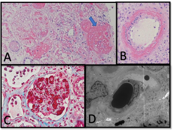 Fig. 1