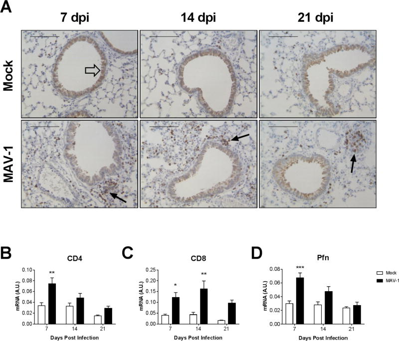 Contributions of CD8 T Cells to the Pathogenesis of Mouse Adenovirus ...