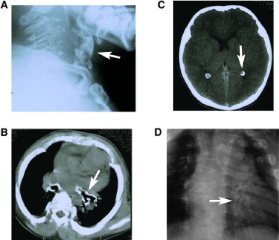 Figure 2