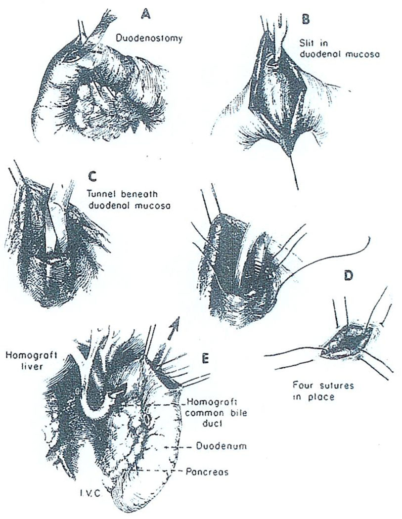 Fig. 16