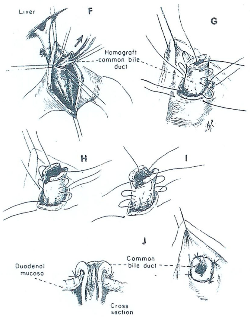 Fig. 17