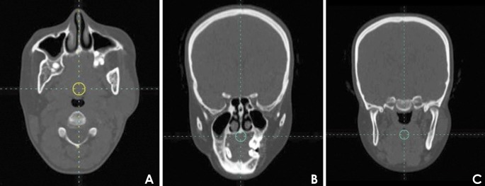 Fig. 3