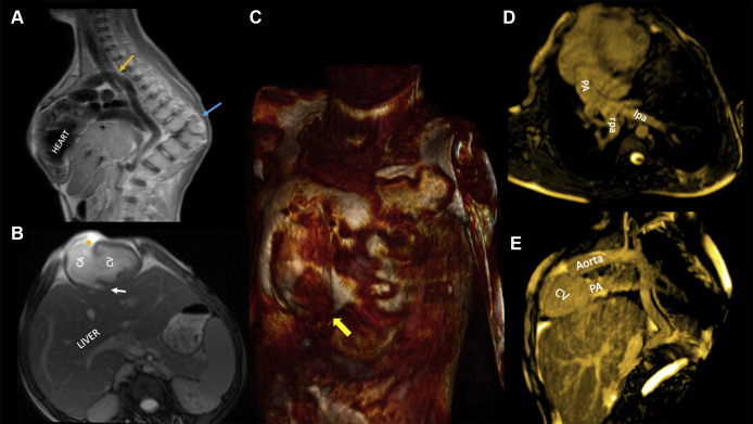 Figure 2