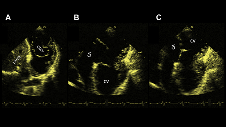 Figure 1