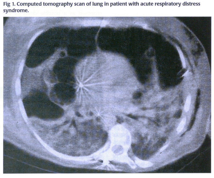 Fig 1.