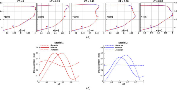 (a) Midcoronal profiles of model 1 (solid line) and model 2 (dashed line) at five phases within one oscillatory cycle (Due to the much smaller displacement difference between the two models as compared to the vertical dimension of vocal fold, the x-axis scale is enlarged to better show the difference). From top to bottom, the dot and cross markers indicate the superior and inferior aspect of the vocal fold and the junction of the conus elasticus and ligament. (b) Superior (dashed–dotted line), inferior (solid line), and junction (dash line) medial-lateral (x-direction) displacement waveforms over steady-state cycles of the two models. Left, model 1; right, model 2. Data correspond to the cases of 1.0 kPa subglottal pressure.