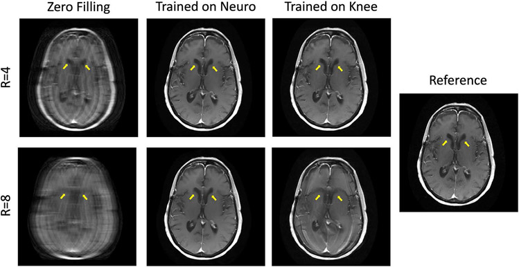 Fig. 4: