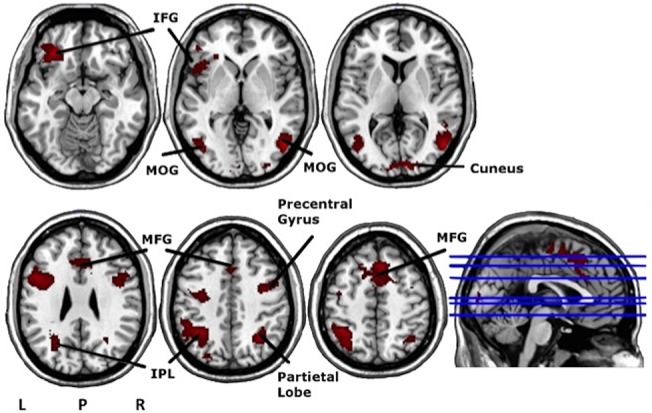 Fig 3