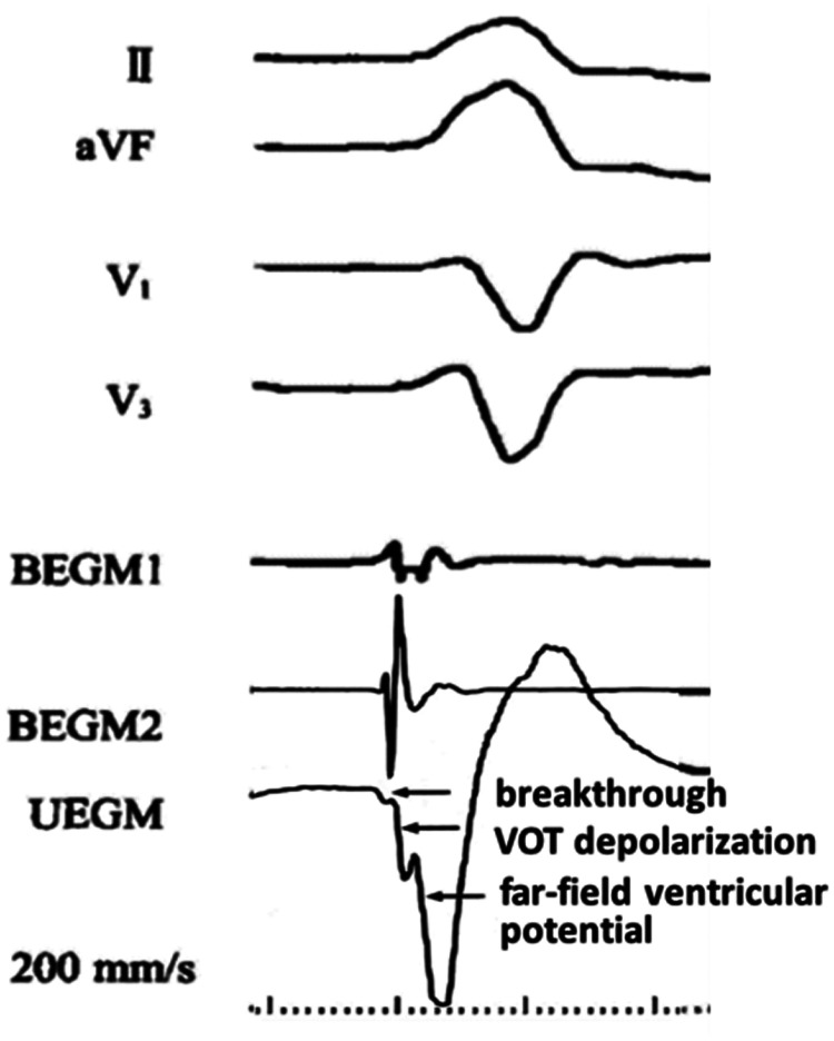 Figure 2.