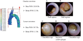 Fig.3.
Representative images of color mapping of WSS and NOGA findings of the aortic arch