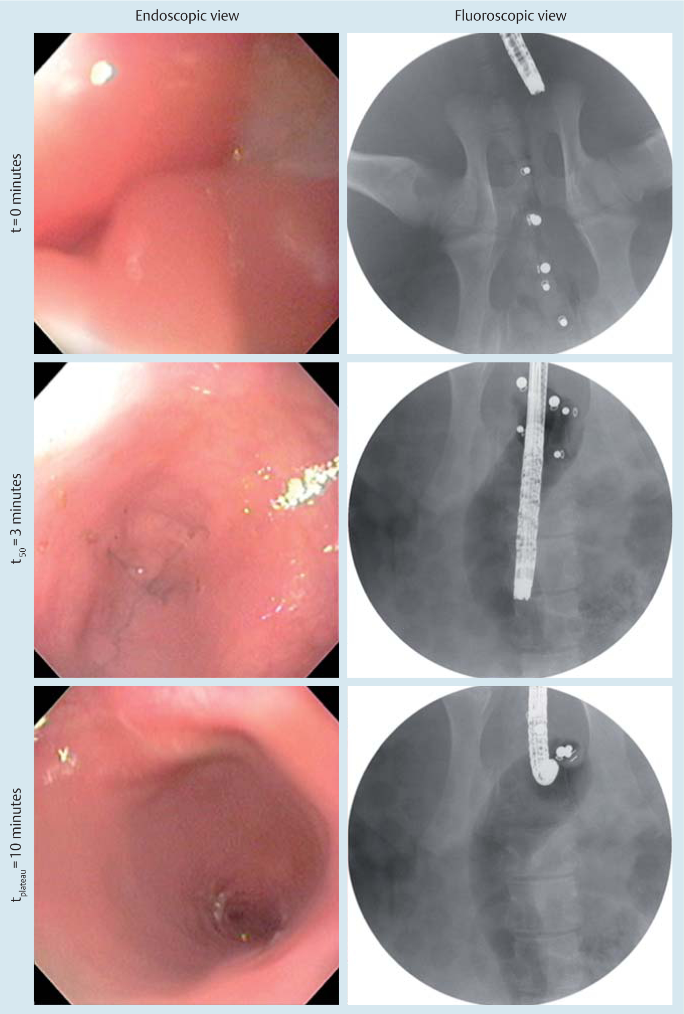 Fig.3