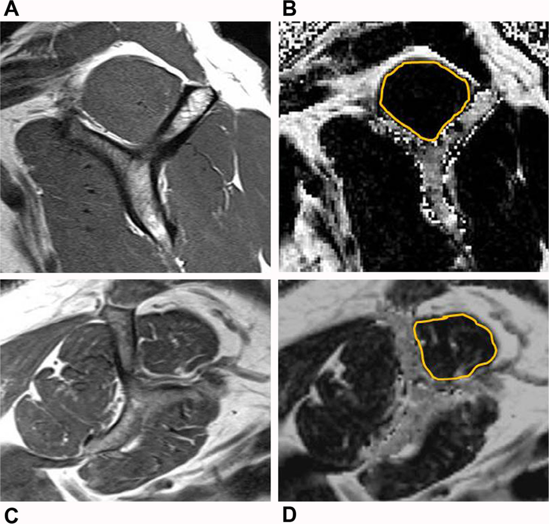 FIG 2.