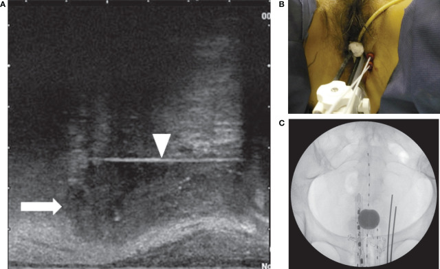 Figure 2