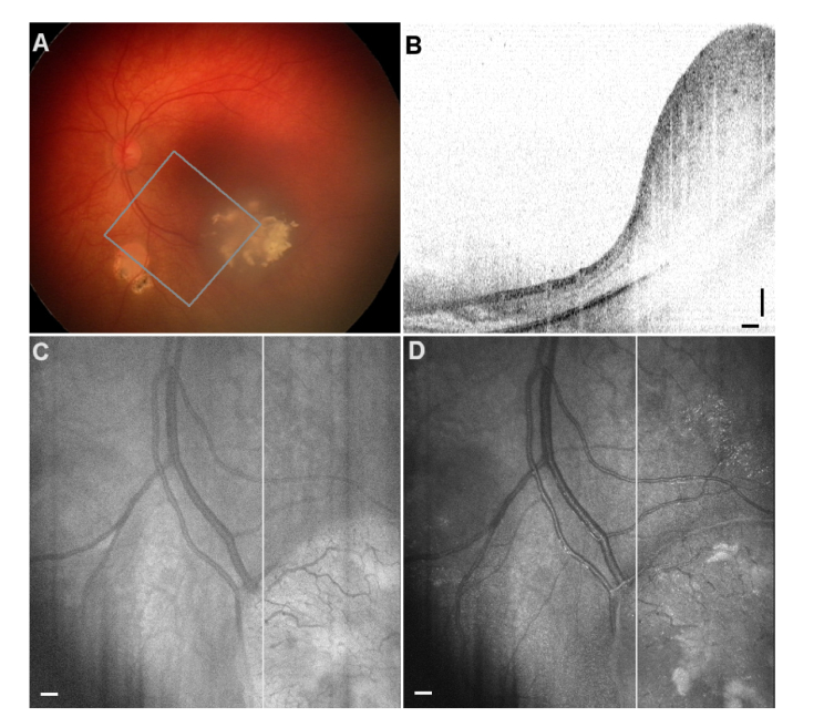 Fig. 2