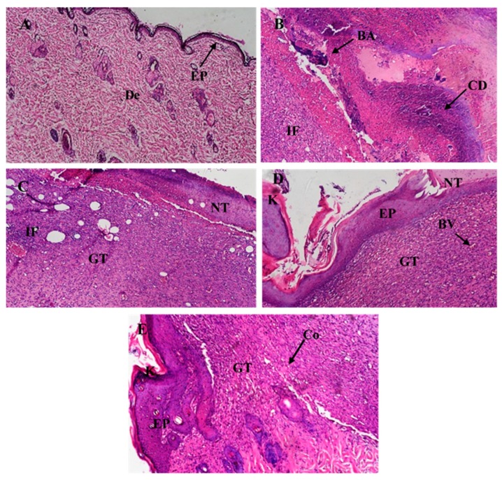 Figure 13