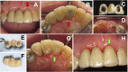 Fig 5