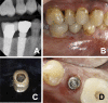 Fig 7