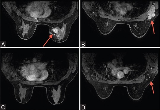 Figure 1 (A-D)