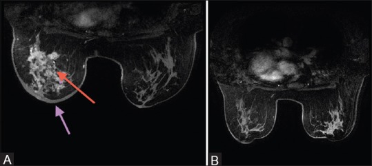 Figure 3 (A and B)