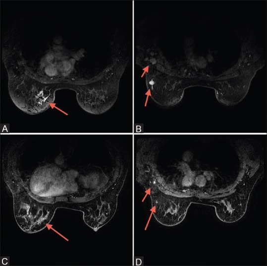 Figure 2 (A-D)