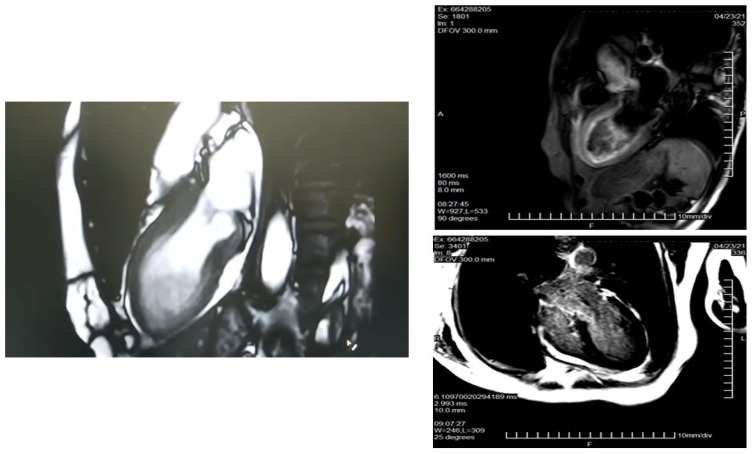 Figure 5