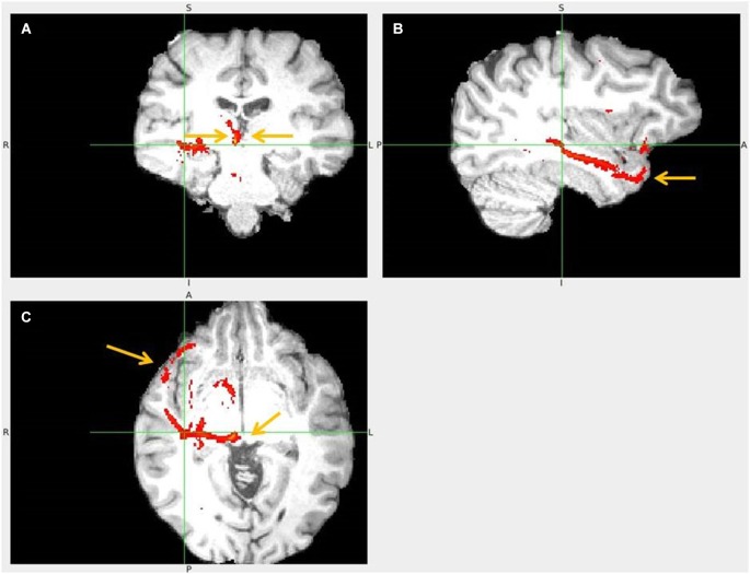 Figure 15