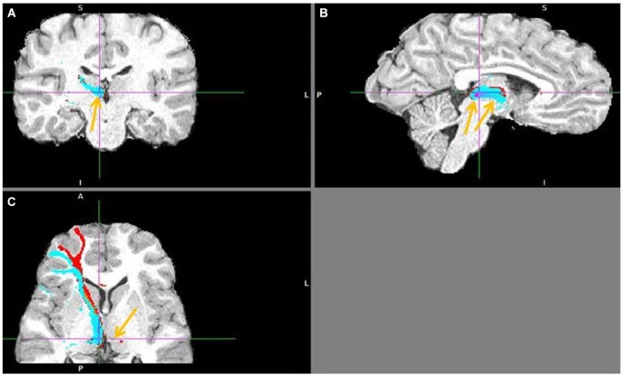 Figure 13