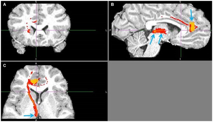 Figure 11