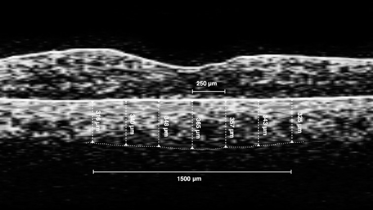 Fig. 2