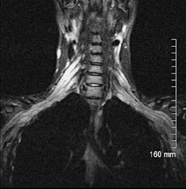 Figure 21