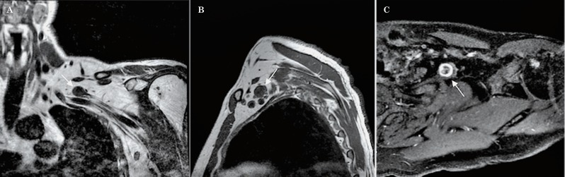 Figure 23