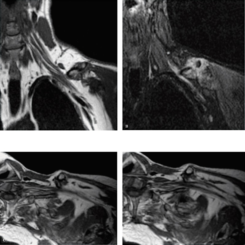 Figure 18