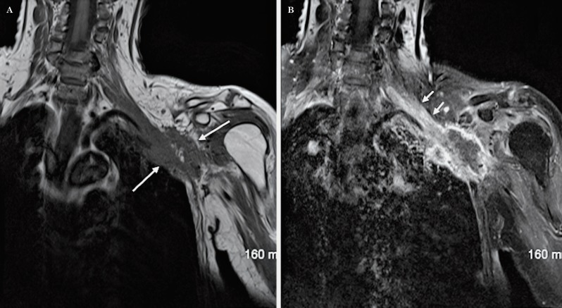 Figure 25