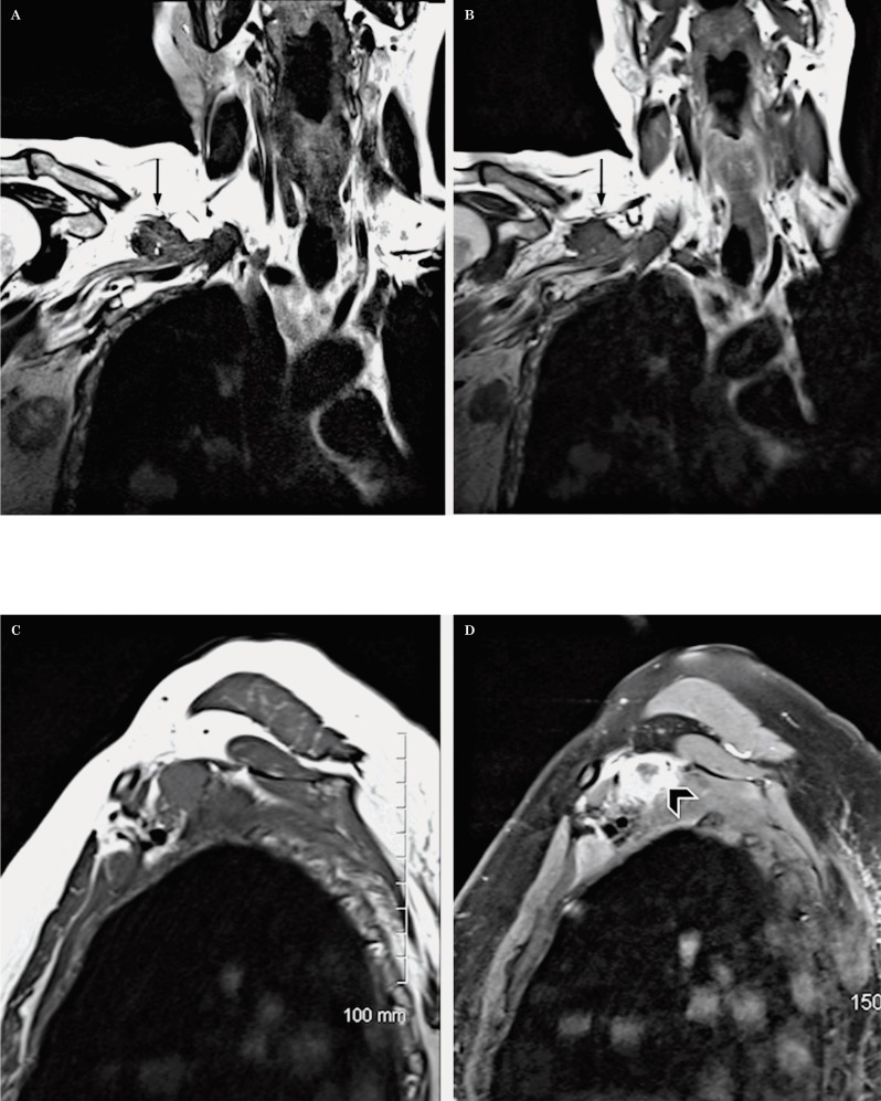 Figure 26