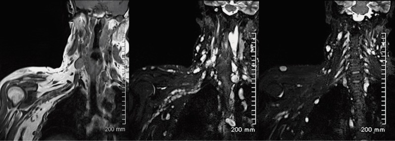 Figure 22