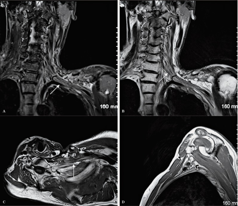 Figure 29